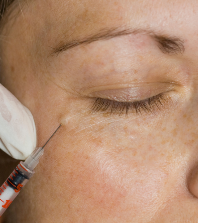 profhilo under eye injectable treatment