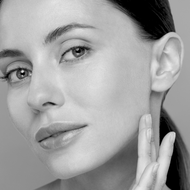 radiesse treatment woman skin mono